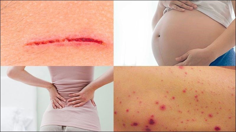 Giác hơi cần được cẩn trọng với một số đối tượng đặc biệt