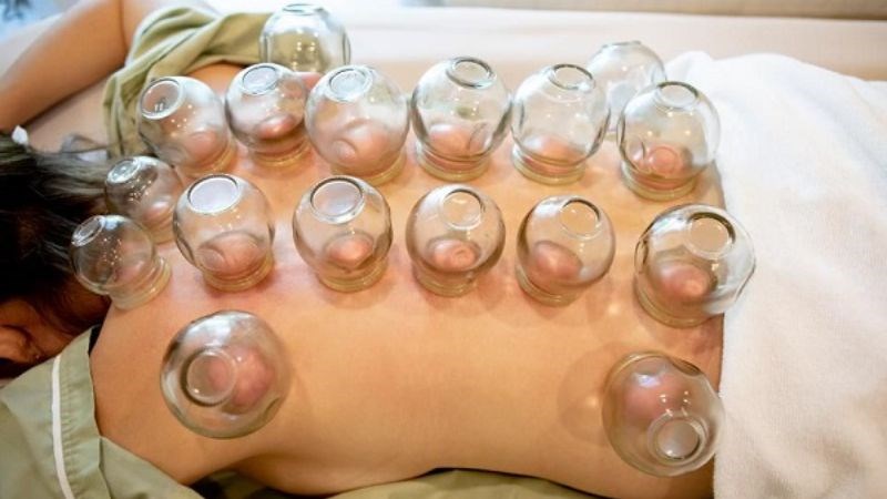 Cần chọn phương pháp giác hơi phù hợp với mỗi đối tượng