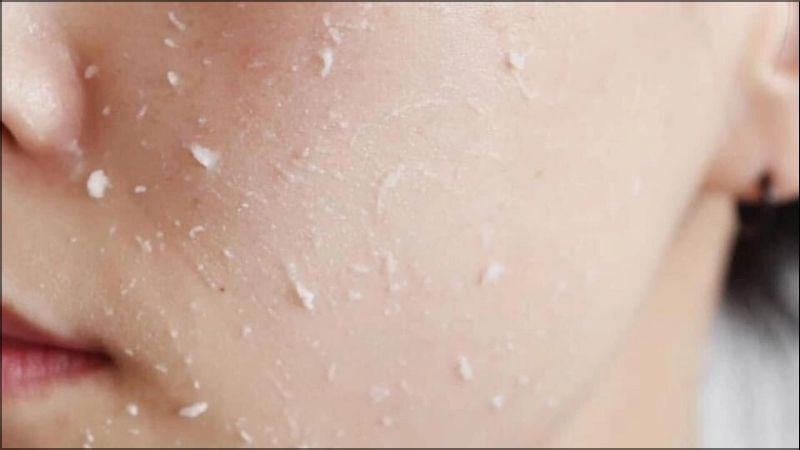 Bạn không nên tẩy tế bào chết quá nhiều khiến làn da bị khô ráp và lão hóa