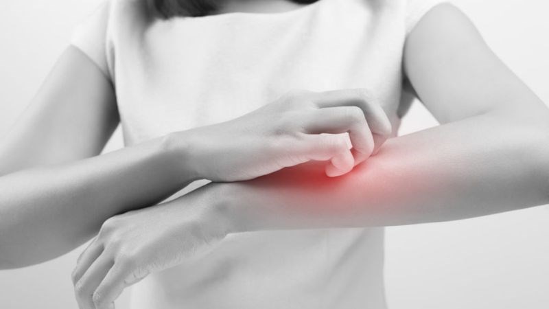 Tìm đến bác sĩ để được thăm khám khi vùng da viêm bị đau hoặc nhiễm trùng Các dấu hiệu cần gặp bác sĩ