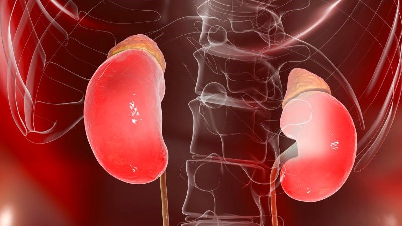 Nhiều báo cáo cho thấy sử dụng cỏ mỹ làm suy giảm chức năng thận