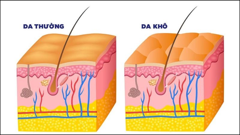 Nước tẩy trang có thể phù hợp với những bạn từ da thường đến da khô