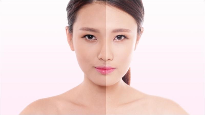 Vitamin C ức chế quá trình tăng sinh melanin và làm mờ vết thâm