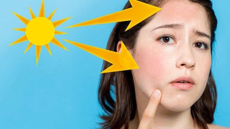 Sự kết hợp giữa vitamin C và vitamin E giúp làm dịu vết cháy nắng