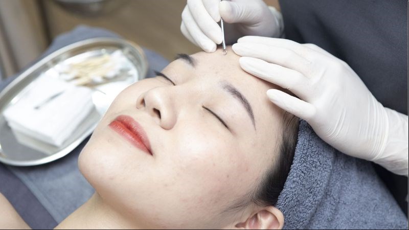 Việc chăm sóc da sau khi nặn mụn là bước quan trọng giúp phục hồi làn da đã bị hư tổn