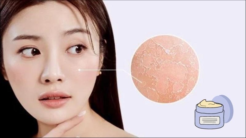 Da kh&ocirc; n&ecirc;n chọn dưỡng ẩm dạng kem hoặc thuốc mỡ để cung cấp đủ độ ẩm