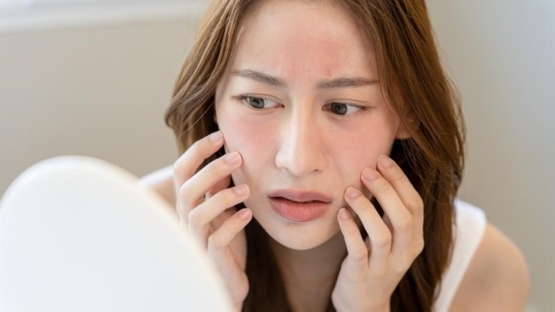 Kem dưỡng ẩm dịu nhẹ sẽ gi&uacute;p phục hồi c&aacute;c l&agrave;n da bị tổn thương