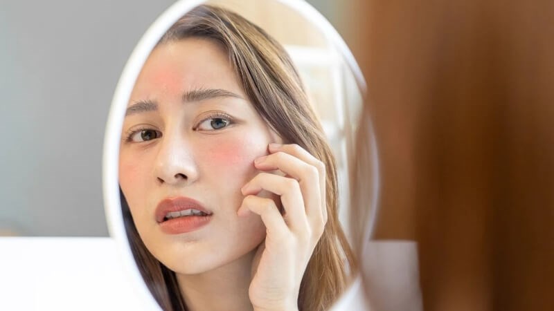 Da bị ngứa, nổi mẩn đỏ là dấu hiệu bị dị ứng kem chống nắng