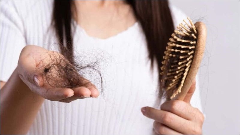 Rụng tóc khi điều trị hóa chất khiến người bệnh lo lắng và tự ti