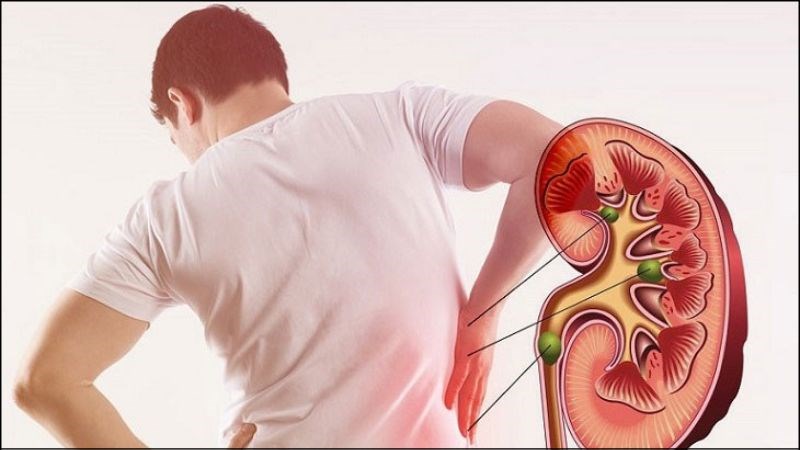 Uống rượu bia nhiều có thể gây ra tình trạng suy thận cấp