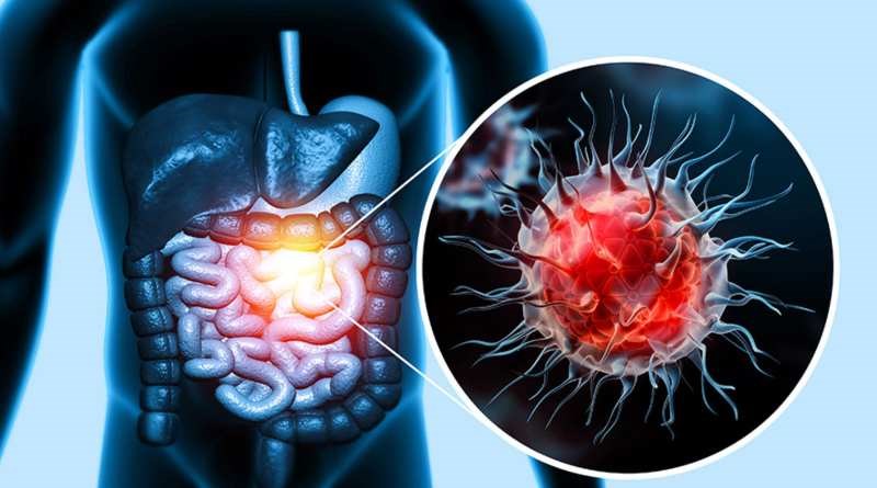 Tinh dầu hương thảo có khả năng ngăn chặn sự phát triển của tế bào ung thư