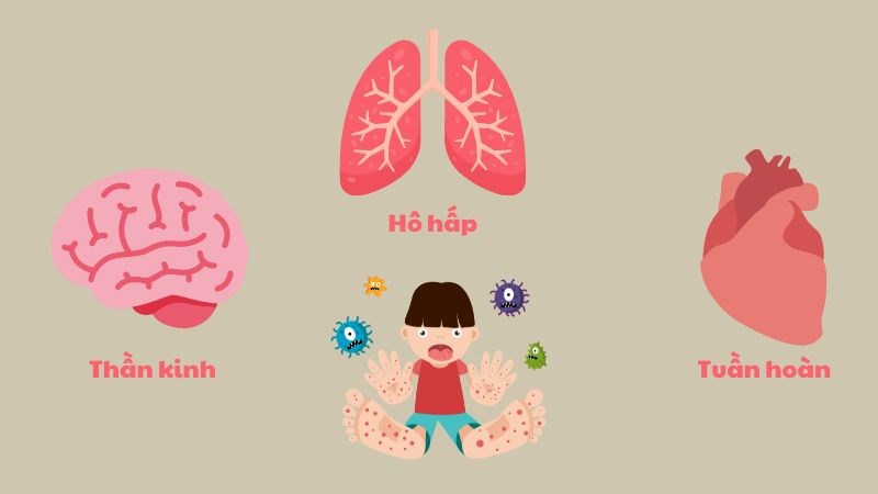 Tay chân miệng có thể gây các biến chứng ở các hệ cơ quan trong cơ thể Tay chân miệng có thể gây các biến chứng ở các hệ cơ quan trong cơ thể