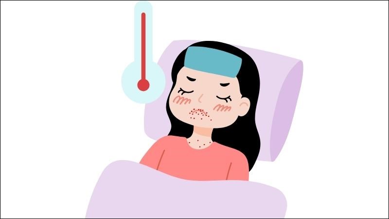 Trẻ mắc bệnh tay chân miệng hay bệnh thủy đậu đều có biểu hiện sốt và phát ban