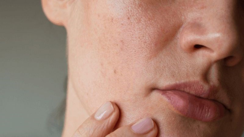 Da kh&ocirc; n&ecirc;n sử dụng c&aacute;c sản phẩm chăm s&oacute;c da dưỡng ẩm cao