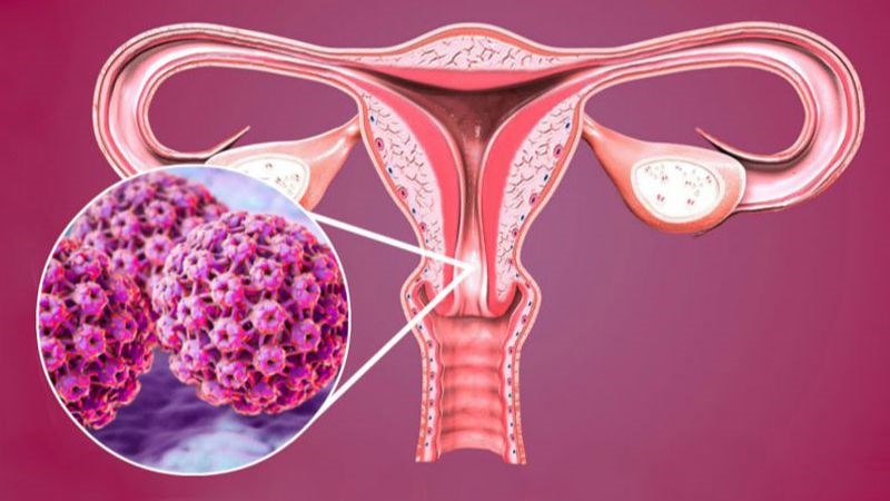HPV lây truyền qua quan hệ tình dục bằng đường sinh dục hoặc bằng miệng