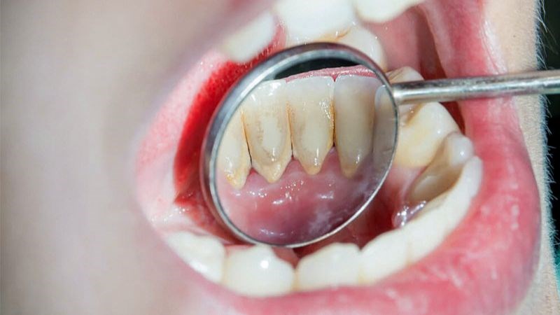 nên kiểm tra tình hình sức khỏe răng miệng thường xuyên khi quan hệ tình dục bằng miệng.