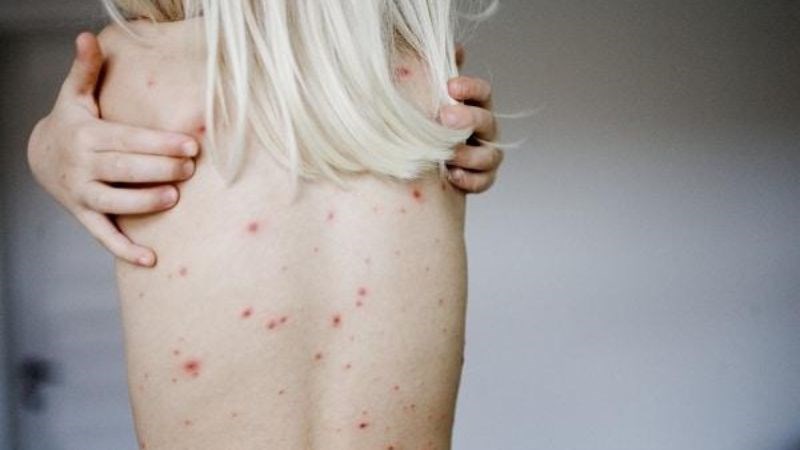 Quan hệ tình dục bằng miệng có thể gây ra bệnh giang mai
