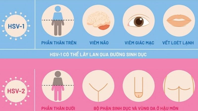 HSV-2 chủ yếu lây qua âm đạo hay hậu môn
