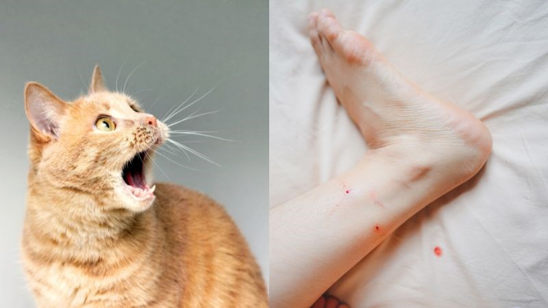 Hiện nay vẫn chưa có phương pháp điều trị bệnh dại khi bị mèo cắn