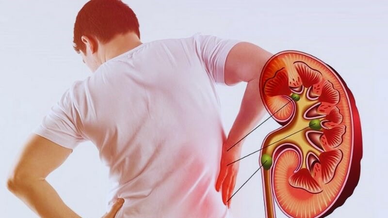 Lá ổi giúp hạn chế các biến chứng trên thận ở bệnh nhân tiểu đường