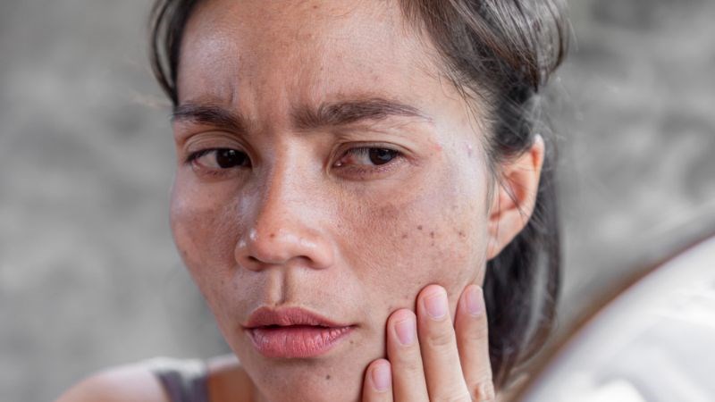 Da trở nên sỉn màu nếu không tẩy trang trước khi đi ngủ Da trở nên sỉn màu nếu không tẩy trang trước khi đi ngủ