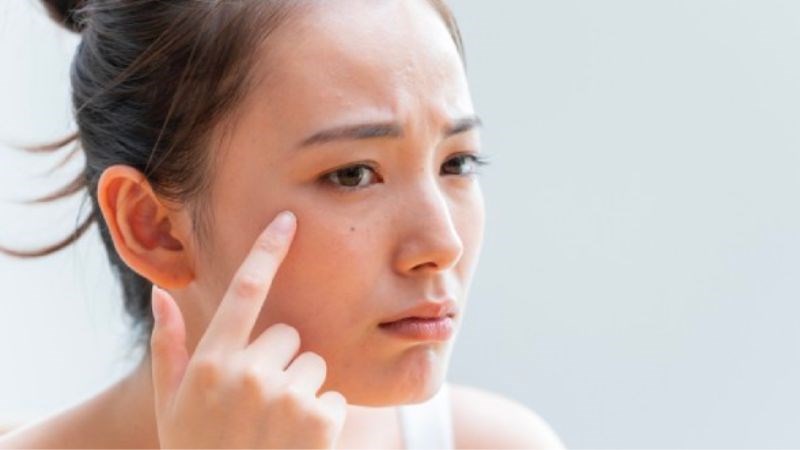 Bụi bẩn và bã nhỡn cản trợ sự hấp thu của dưỡng chất vào da Bụi bẩn và bã nhờn cản trở sự hấp thu của dưỡng chất vào da