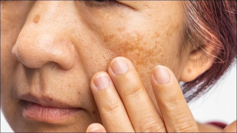 Tinh dầu sả chanh có thể làm chậm quá trình lão hóa da