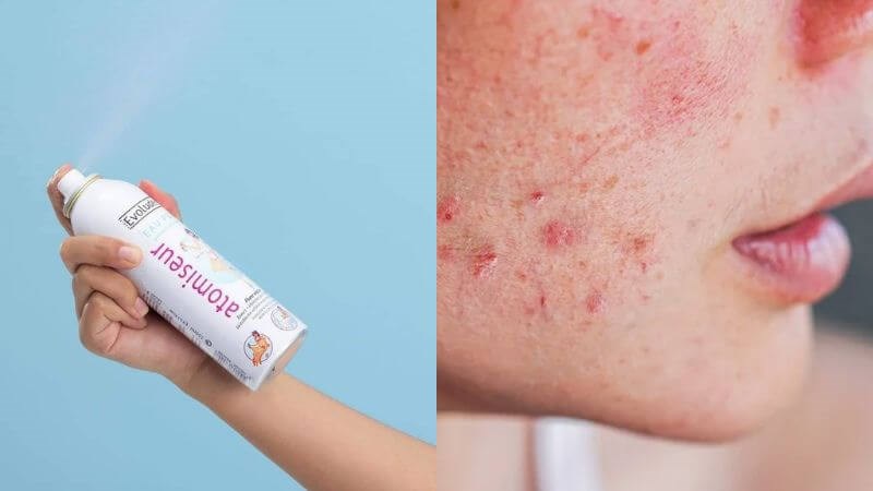 Các thành phần trong xịt khoáng giúp làm dịu da, giảm tình trạng sưng đỏ
