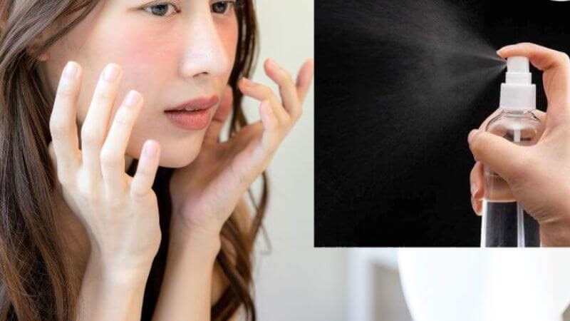 Xịt khoáng làm giảm nguy cơ bùng phát mụn trên da