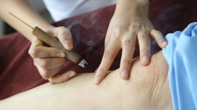 Moxibustion là liệu pháp đông y được thực hiện bằng cách hơ nóng các huyệt vị trên cơ thể