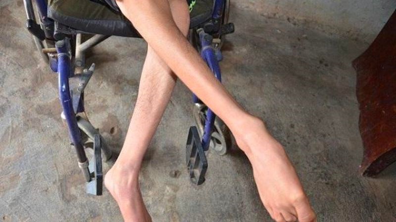Ba kích được phối hợp với một số vị thuốc khác để cải thiện tình trạng teo cơ