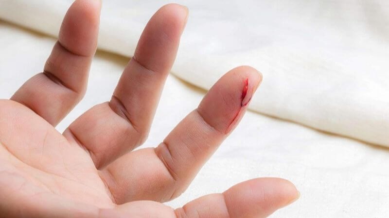 Vitamin E làm cản trở khả năng đông máu