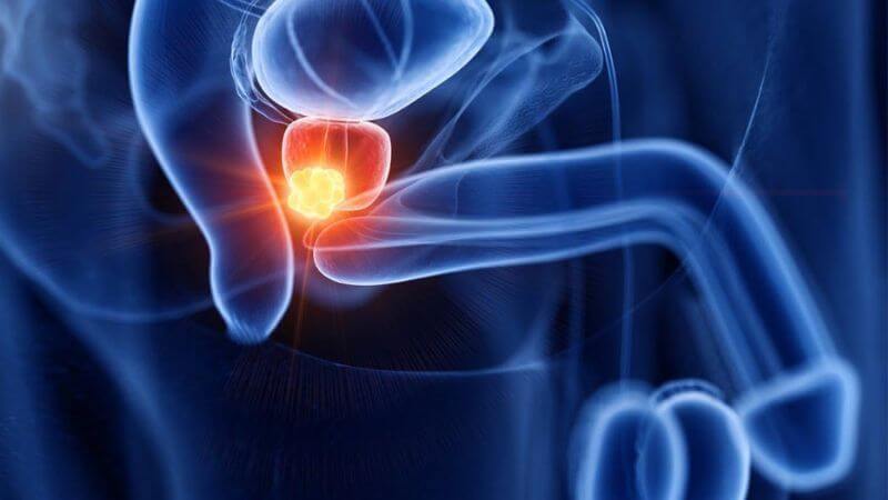 Vitamin E có thể làm tăng nguy cơ phát triển ung thư tuyến tiền liệt