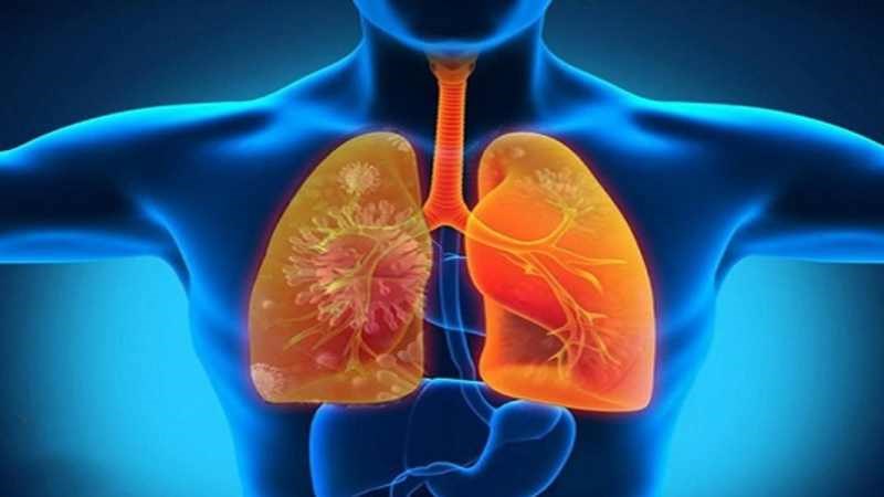 Theo Đông y, cá lóc được sử dụng rất tốt cho những người bị bệnh về phổi
