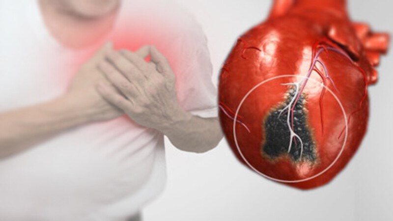 Ăn mặn quá nhiều có thể dẫn đến các bệnh về tim mạch
