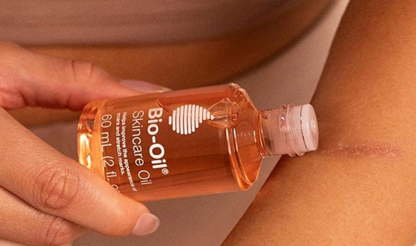 Tinh dầu Bio Oil giúp làm mờ sẹo