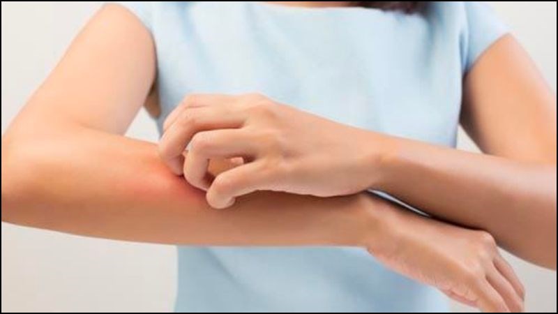 Khi sử dụng sữa dưỡng thể hết hạn có thể gây kích ứng cho da