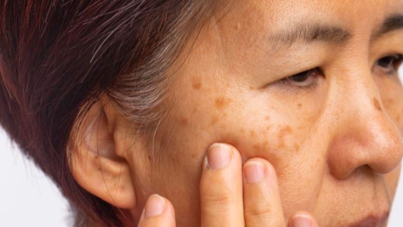 Lão hoá do nhiễm chì có thể được gây ra bởi nhiều nguyên nhân Lão hoá do nhiễm chì có thể được gây ra bởi nhiều nguyên nhân