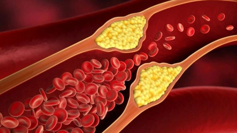 Ăn nhiều tôm có thể làm tăng hàm lượng cholesterol trong máu 