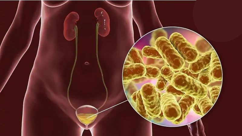 Cẩm tú cầu là lựa chọn trong điều trị nhiễm trùng đường tiết niệu