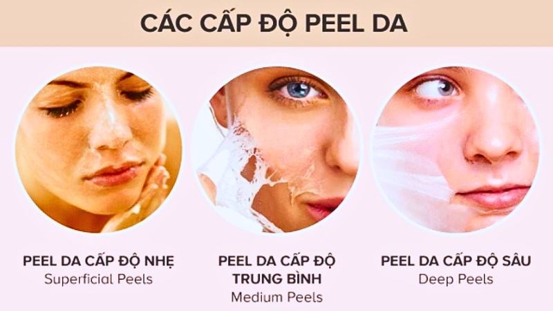 Lựa chọn cấp độ peel da tùy thuộc vào vấn đề trên da và loại da của mỗi người