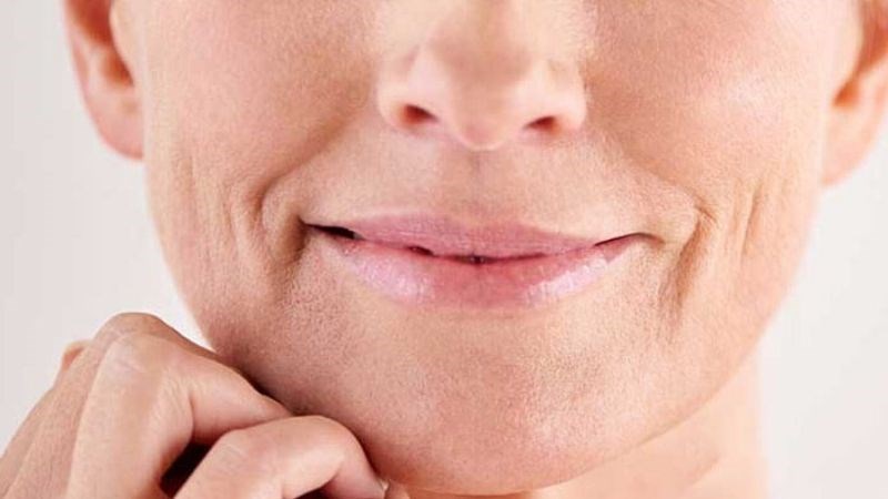 Peel da kích thích tăng sản xuất collagen và tái tạo tế bào mới nhằm giảm nếp nhăn