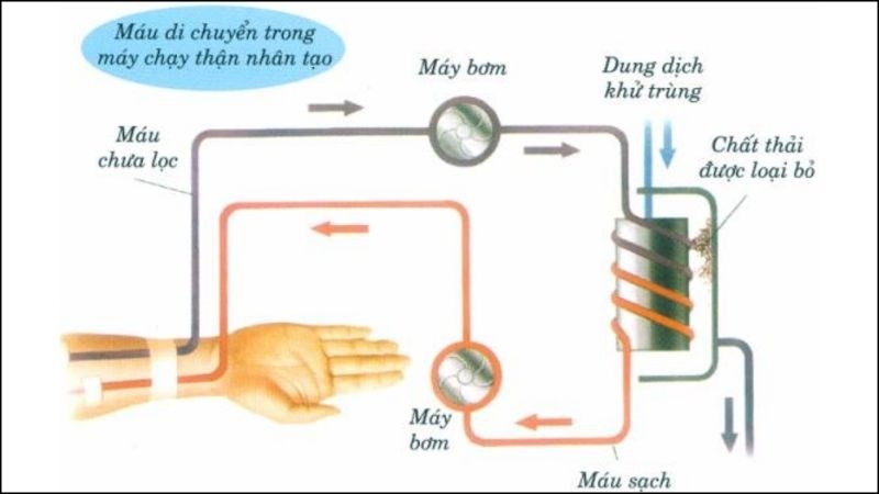 Quy trình của chạy thận nhân tạo