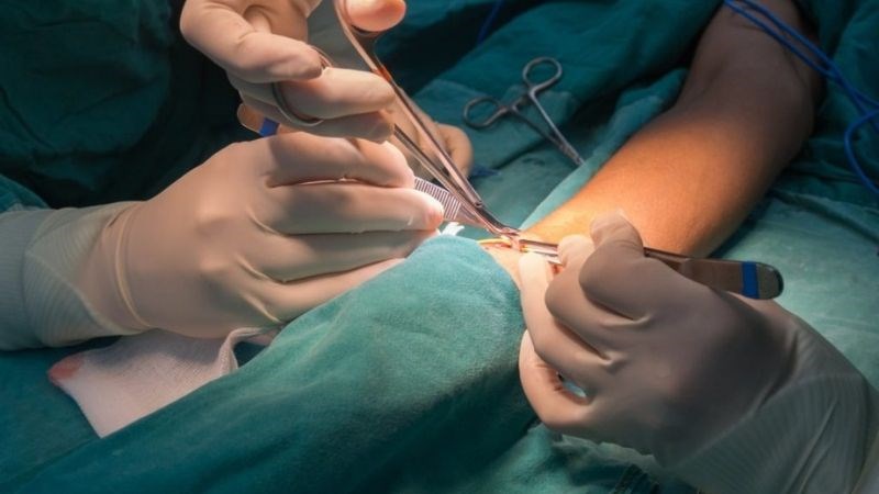 AVG được thực hiện khi động tĩnh mạch của bệnh nhân quá ngắn để nối với nhau