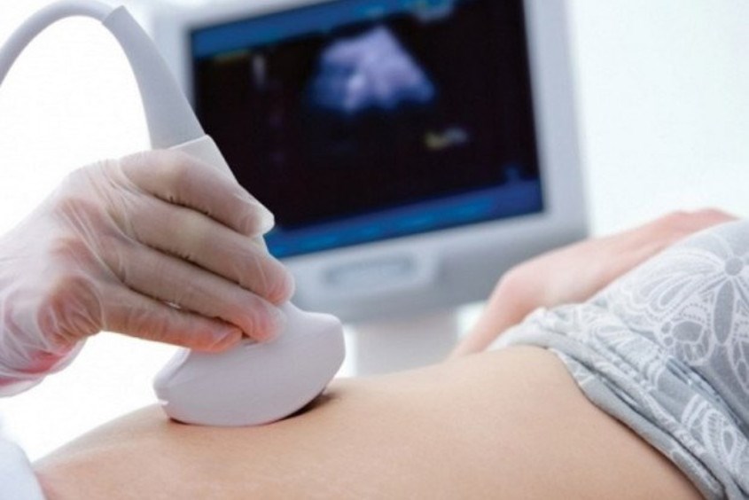 Có thể siêu âm ở tuần thứ 2 nhưng kết quả không chính xác