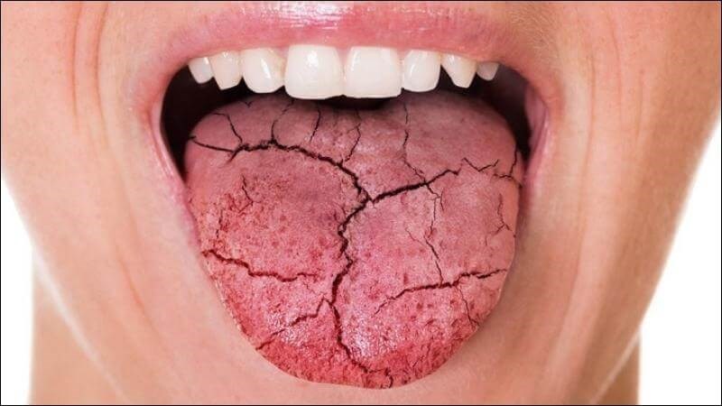Thuốc chống trầm cảm có thể gây tác dụng phụ khô miệng