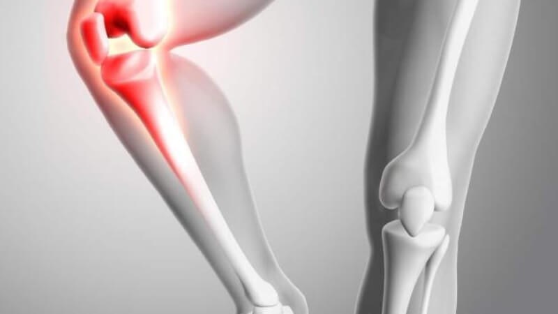 Cây thì là cung cấp canxi giúp duy trì sức khỏe xương