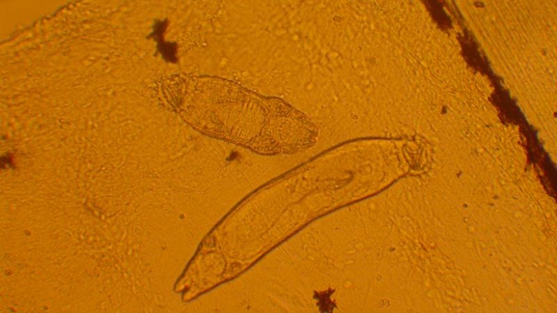 S&aacute;n l&aacute; gan l&agrave; một trong những nguy&ecirc;n nh&acirc;n h&agrave;ng đầu g&acirc;y ngộ độc thực phẩm