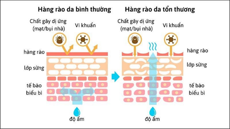 Sữa dưỡng thể giúp da sáng khoẻ tự nhiên và bảo vệ hàng rào của da