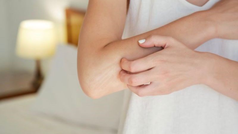 Dị ứng là nguyên nhân chính gây ngứa khi dùng sữa dưỡng thể